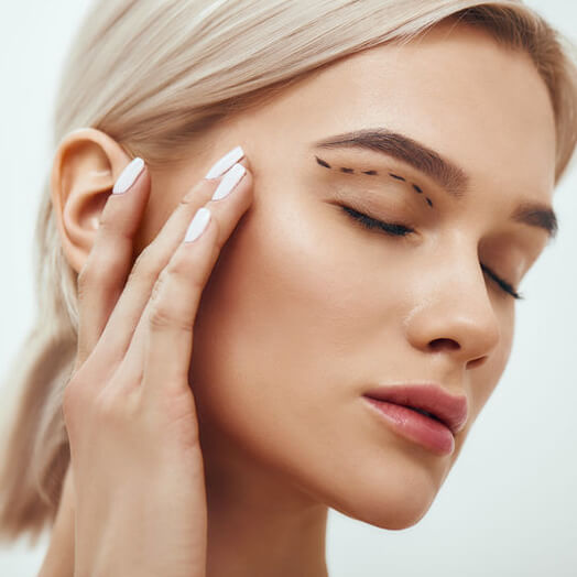 Blépharoplastie
